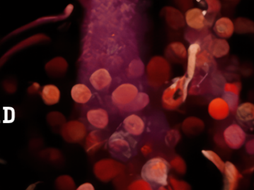EXTENDED: Entangled Others – Sediment Nodes